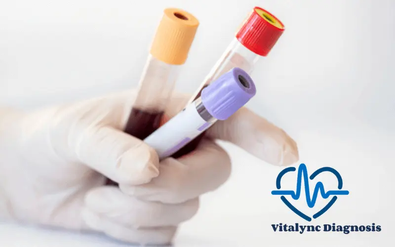 Diabetes Profile 1