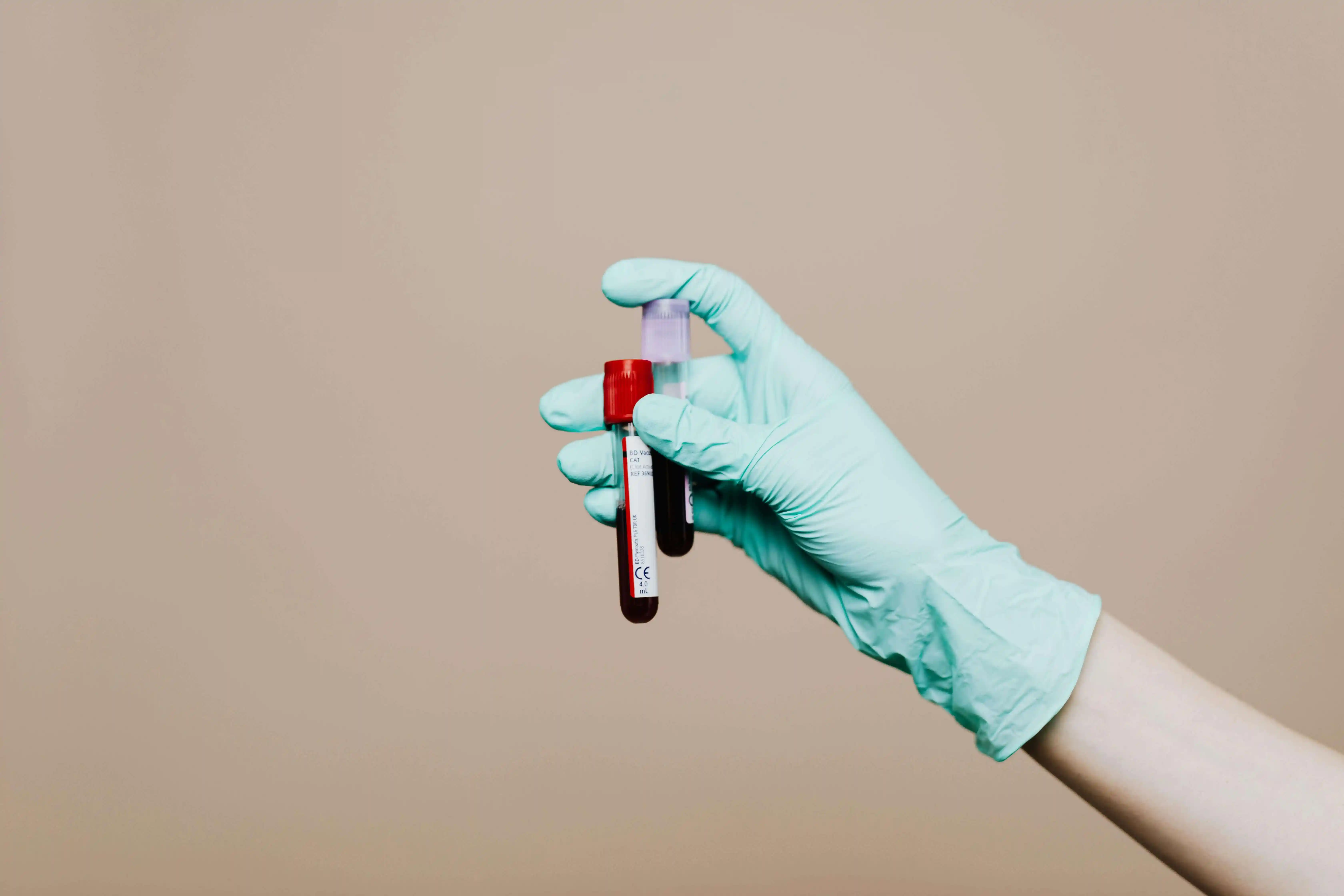 Blood Testing for Vitamin Deficiencies: Signs You Might Be Lacking Key Nutrients
