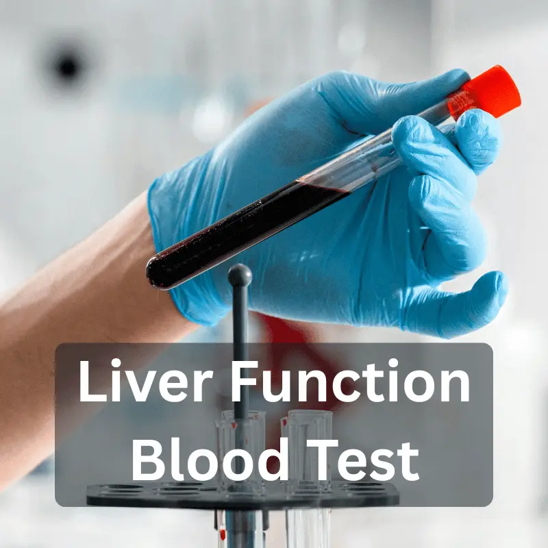 Liver Function Test in Slough & London