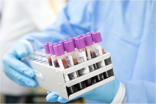 TRT FAQ - Blood Test Sample Tubes
